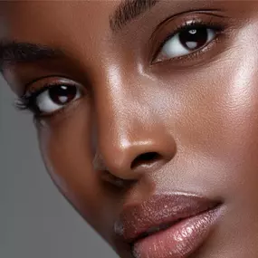 Radiesse & Hyperdiluted Radiesse dermal filler injection