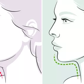 Get Rid of Your Turkey Neck
