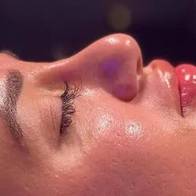 Facial