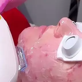 Stellar facial