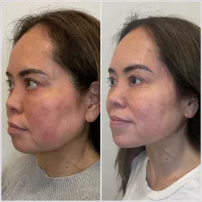 Best Med Spa in Chandler, AZ