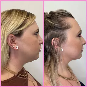 Best Med Spa in Chandler, AZ