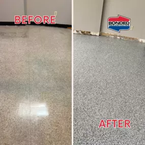 Bild von Bonded Resurfacing