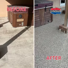 Bild von Bonded Resurfacing
