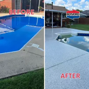 Bild von Bonded Resurfacing