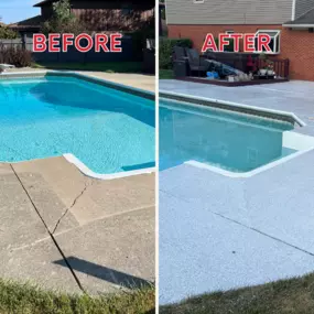Bild von Bonded Resurfacing