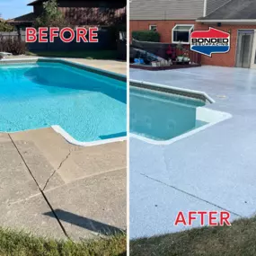 Bild von Bonded Resurfacing