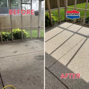 Bild von Bonded Resurfacing