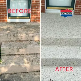 Bild von Bonded Resurfacing