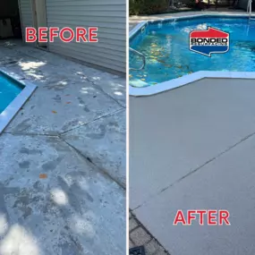 Bild von Bonded Resurfacing