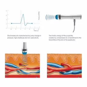 Bild von Medray Laser & Technology