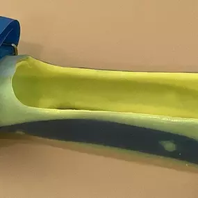 Bild von Sanitätshaus Orthopädietechnik Meyer