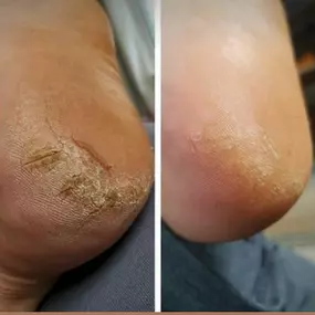 PEDICURA-COMPLETASAN-SEBASTIAN-DE-LOS-REYES.jpg