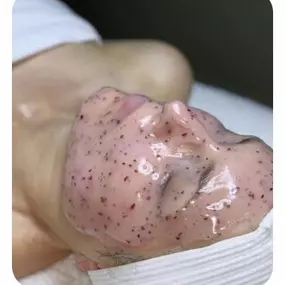TRATAMIENTO-FACIAL-SAN-SEBASTIAN-DE-LOS-REYES.jpg