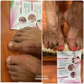 PEDICURA-SPA-SAN-SEBASTIAN-DE-LOS-REYES.jpg