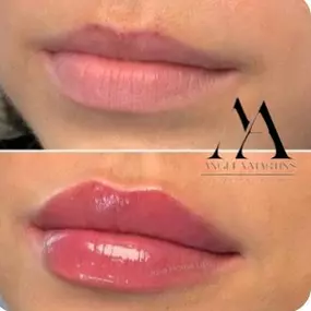 LABIOS-SAN-SEBASTIAN-DE-LOS-REYES.jpg