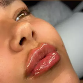 LABIOS-AUMENTO-SAN-SEBASTIAN-DE-LOS-REYES.jpg