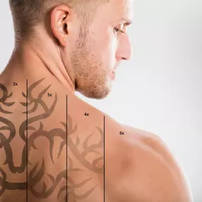 Bild von East Coast Laser Tattoo Removal