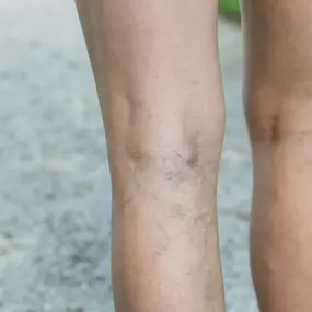 Bild von Jersey Shore Foot & Leg Center