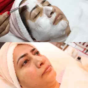 See the difference Before/ After
#facial