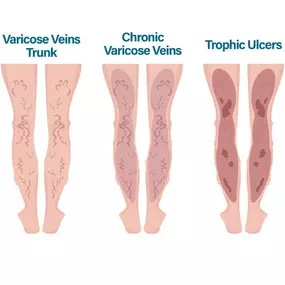 Bild von Physicians Vein Clinics