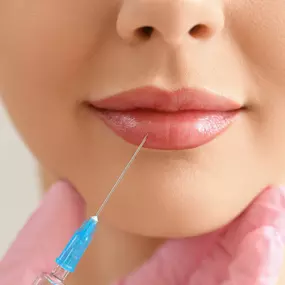 A professional is administering a lip filler injection with a syringe into the upper lip area. The blue-tipped needle is clearly visible against the person's slightly parted, shiny lips.