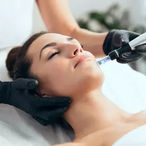 A close-up of a person's face being treated with a microneedling device around the mouth and chin. A professional in black gloves holds the device, with the person's eyes closed.