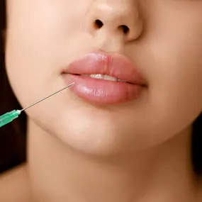 A close-up of a woman's face receiving a lip injection. A syringe with a green needle tip is positioned at the edge of her plump, shiny lips, indicating a cosmetic procedure.
