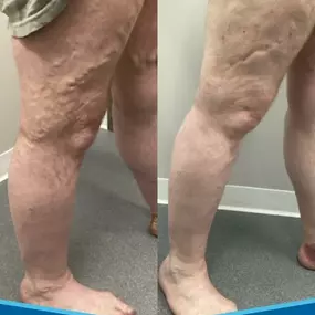 Bild von Physicians Vein Clinics