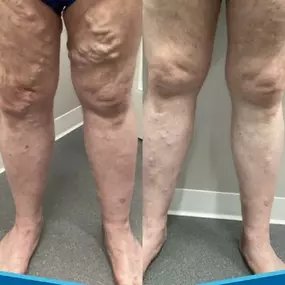Bild von Physicians Vein Clinics