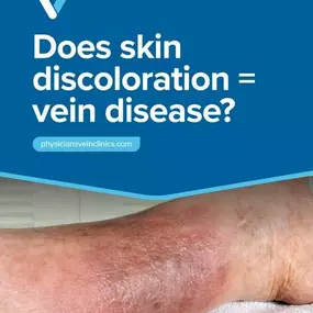 Bild von Physicians Vein Clinics