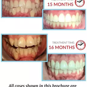 Bild von Lifetime Dental & Fastbraces