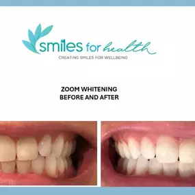 Bild von Dentist Carlsbad - Smiles For Health DDS