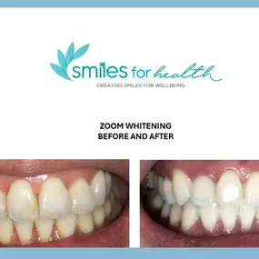 Bild von Dentist Carlsbad - Smiles For Health DDS