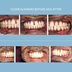 Bild von Dentist Carlsbad - Smiles For Health DDS