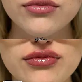 Bild von Bellava MedAesthetics & Plastic Surgery Center