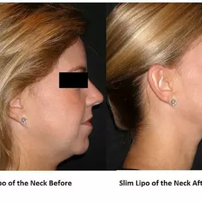 Bild von Bellava MedAesthetics & Plastic Surgery Center