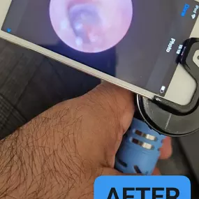 Bild von MW Ear Wax Removal