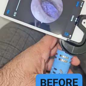 Bild von MW Ear Wax Removal