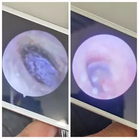 Bild von MW Ear Wax Removal