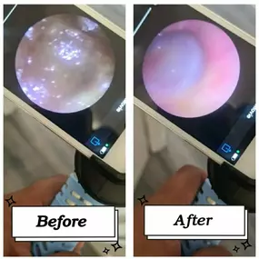 Bild von MW Ear Wax Removal