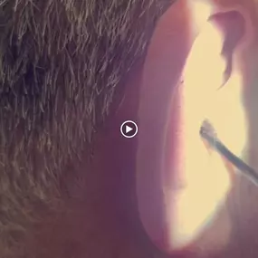Bild von MW Ear Wax Removal