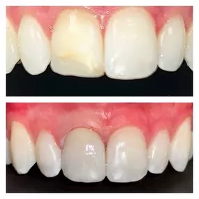 Bild von Aspire Dental Wellness - SouthPark Charlotte