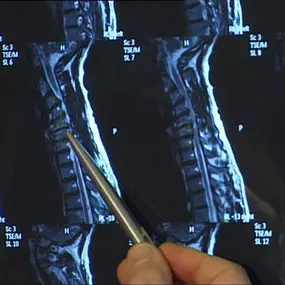 Bild von TWIN Tagesklinik für Wirbelsäulen und Neurochirurgie