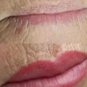 lips-fuenguirola.jpg