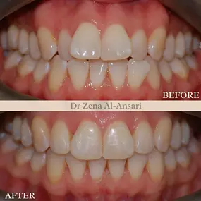 Bild von EB Dental  Worcester Park