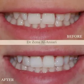 Bild von EB Dental  Worcester Park