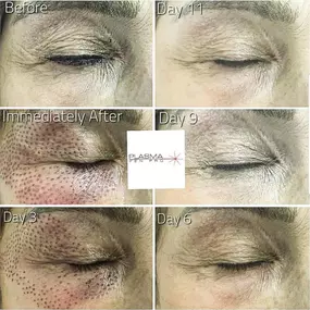 Skin treatments Palm Beach FL
