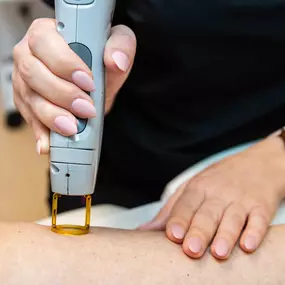 Laser hair removal Jupiter FL
