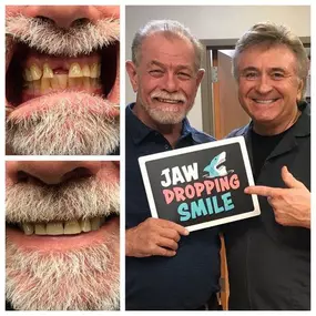Patient Before & After | Mini Dental Implant Centers of America in Springfield, MO | Dr. Thomas Baggett, III